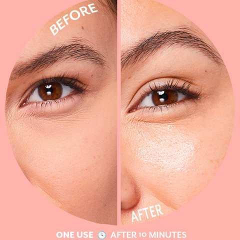 Before and after comparison of a person's eye area with a pink background.
