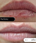 Before and after comparison of lips with a skincare product shown.