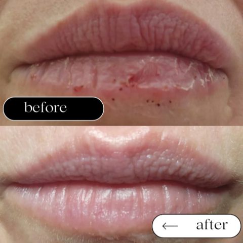 Before and after comparison of lips with a skincare product shown.